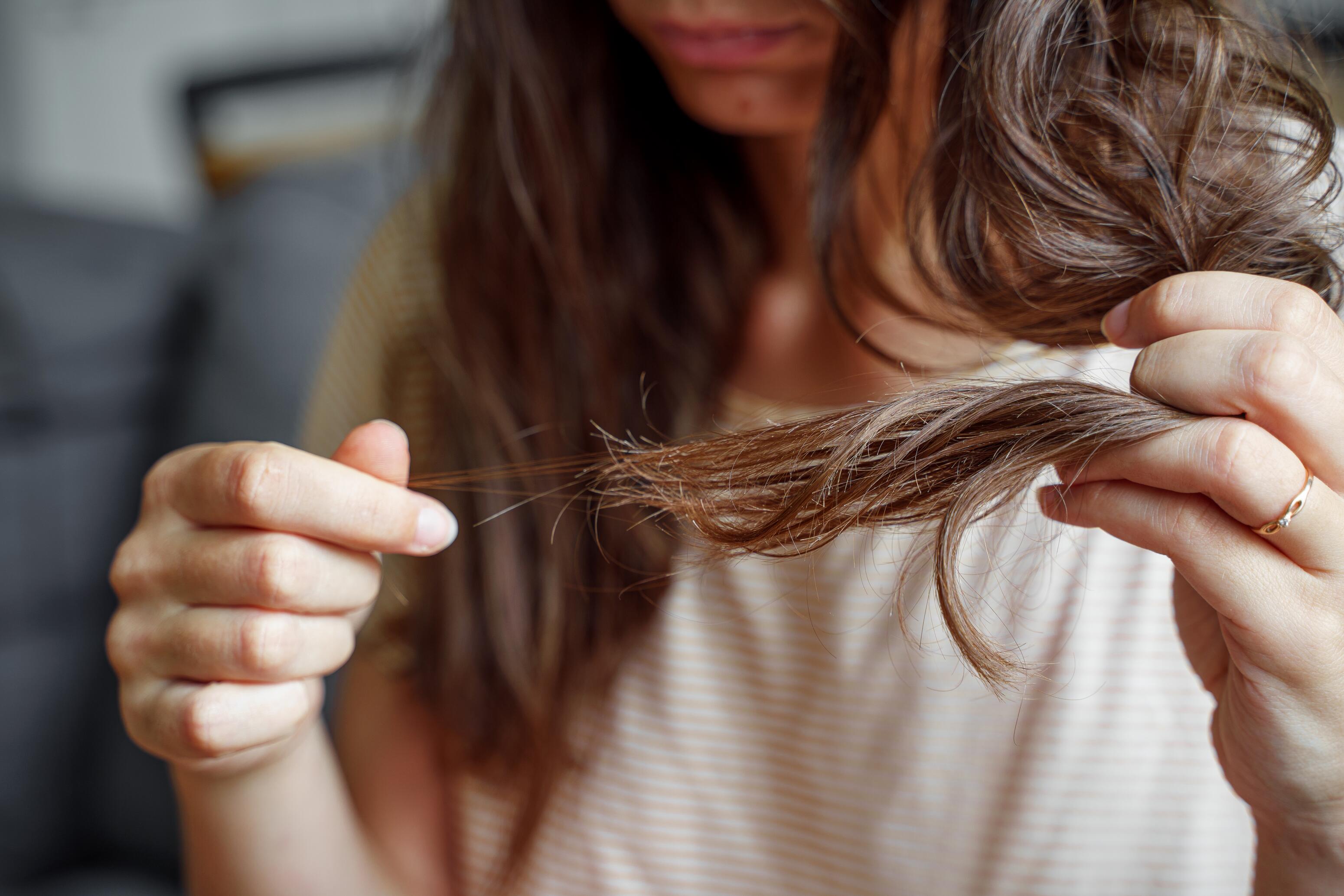 Quand consulter un dermatologue perte de cheveux